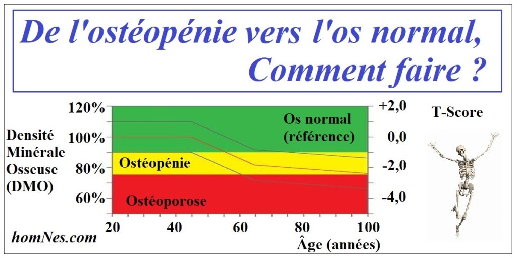 Définition - Ostéoporose & Ostéopénie - Est-ce grave ? - homNes.com