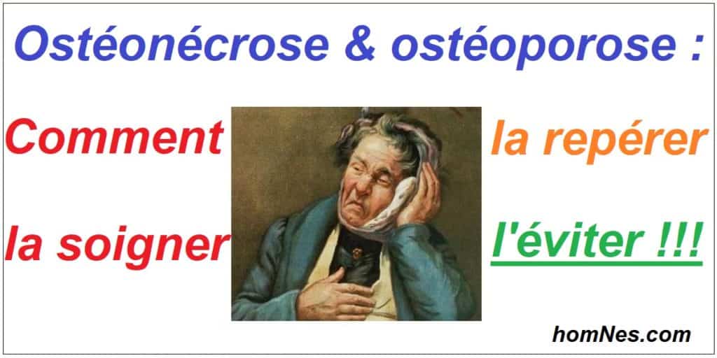 Osténoécrose & ostéoporose : l'éviter, la dépister, la soigner - homNes