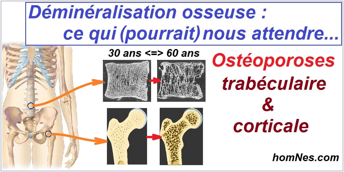 Ostéopénie & ostéoporose : trabéculaire ou corticale - Définition ...